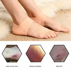 ZaalMaal Silicone Heel Protectors for Cracked Heel Relief