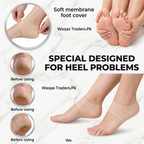 ZaalMaal Silicone Heel Protectors for Cracked Heel Relief